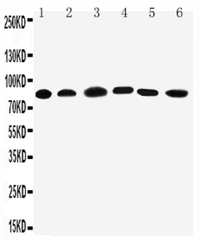 PC1/3/PCSK1 Rabbit Polyclonal Antibody