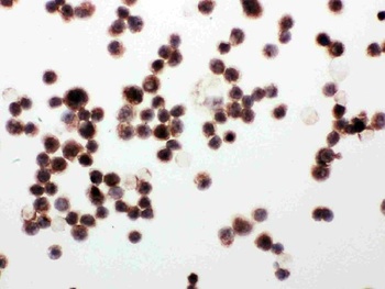 WISP1 Rabbit Polyclonal Antibody