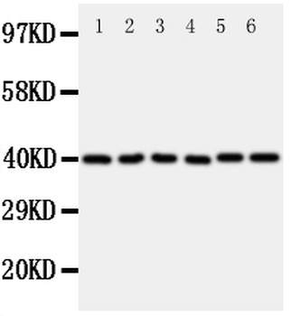 WISP1 Rabbit Polyclonal Antibody