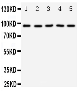TrkC/NTRK3 Rabbit Polyclonal Antibody