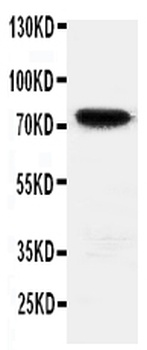 HIF3/HIF3A Rabbit Polyclonal Antibody