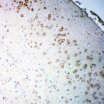 Muscarinic Acetylcholine Receptor 2/CHRM2 Rabbit Polyclonal Antibody