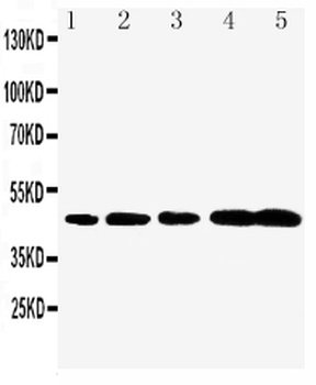 Caspase-1/CASP1 Rabbit Polyclonal Antibody