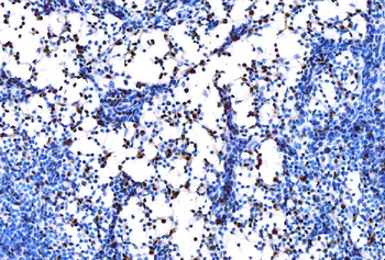 PU.1/SPI1 Antibody