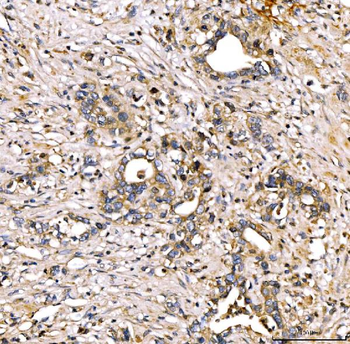 Alpha 2 Antiplasmin/SERPINF2 Antibody