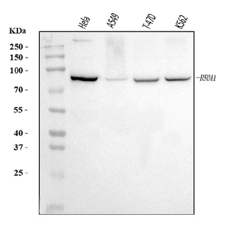RRM1 Rabbit Polyclonal Antibody