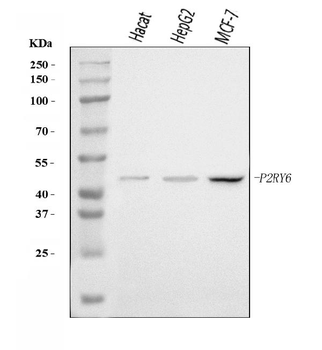 P2Y6/P2RY6 Rabbit Polyclonal Antibody