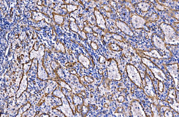 NLRP7 Rabbit Polyclonal Antibody