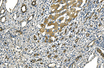 NLRP7 Rabbit Polyclonal Antibody