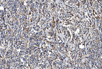 NLRP7 Rabbit Polyclonal Antibody