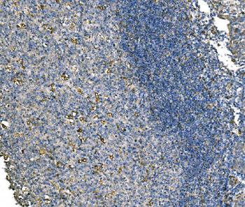 NLRP7 Rabbit Polyclonal Antibody