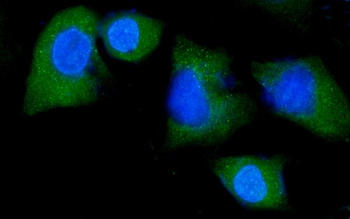 NEDD4 Rabbit Polyclonal Antibody
