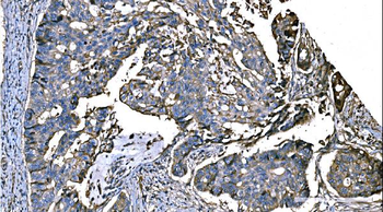 NEDD4 Rabbit Polyclonal Antibody