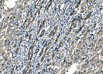 NEDD4 Rabbit Polyclonal Antibody