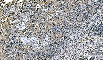 NEDD4 Rabbit Polyclonal Antibody
