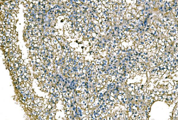 NEDD4 Rabbit Polyclonal Antibody