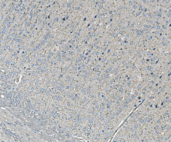 NEDD4 Rabbit Polyclonal Antibody