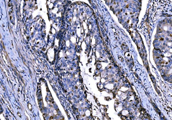 KPNA2 Rabbit Polyclonal Antibody