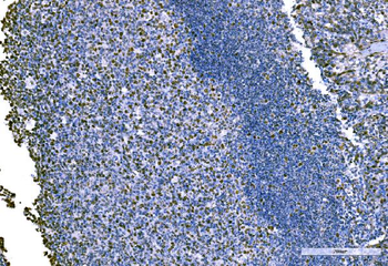 KPNA2 Rabbit Polyclonal Antibody