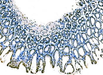 KLF4 Rabbit Polyclonal Antibody