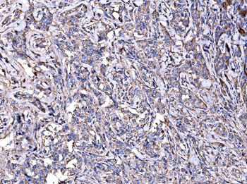 IMPDH1 Antibody