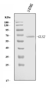 GLS2 Rabbit Polyclonal Antibody