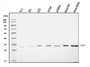 GJB2 Rabbit Polyclonal Antibody