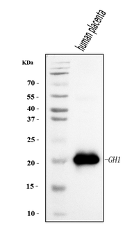 Growth Hormone/GH1 Rabbit Polyclonal Antibody