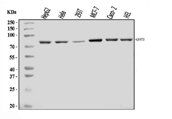 GFPT1 Rabbit Polyclonal Antibody