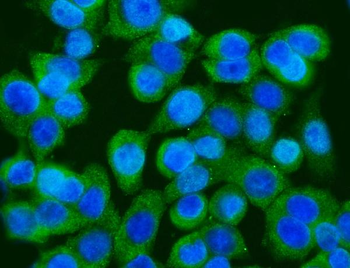 GFPT1 Rabbit Polyclonal Antibody