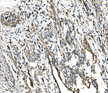 GFPT1 Rabbit Polyclonal Antibody