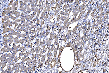 GFPT1 Rabbit Polyclonal Antibody