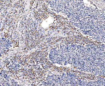 GFPT1 Rabbit Polyclonal Antibody