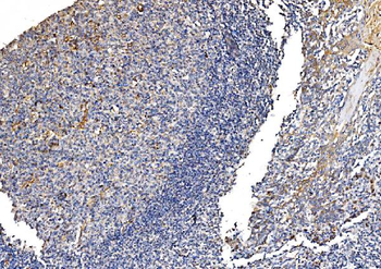 GFPT1 Rabbit Polyclonal Antibody