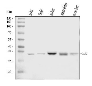 GAS2 Rabbit Polyclonal Antibody