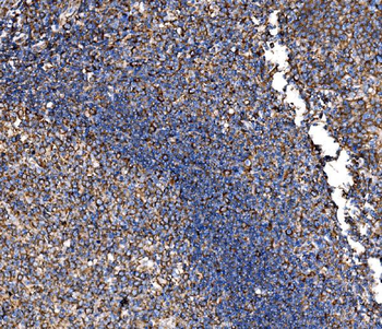 G3BP/G3BP1 Rabbit Polyclonal Antibody