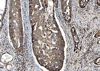 G3BP/G3BP1 Rabbit Polyclonal Antibody