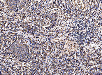 G3BP/G3BP1 Rabbit Polyclonal Antibody