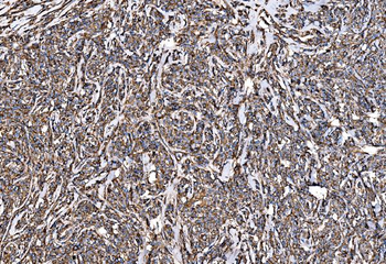 G3BP/G3BP1 Rabbit Polyclonal Antibody