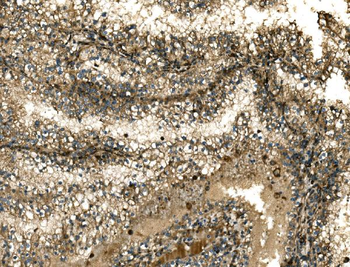 G3BP/G3BP1 Rabbit Polyclonal Antibody