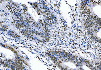 TLS/FUS Rabbit Polyclonal Antibody