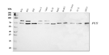 TLS/FUS Rabbit Polyclonal Antibody