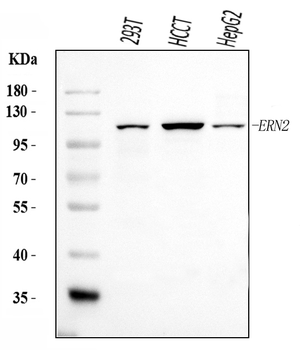 ERN2 Rabbit Polyclonal Antibody