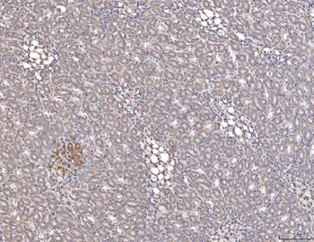 Cathepsin L/MEP/Ctsl Rabbit Polyclonal Antibody