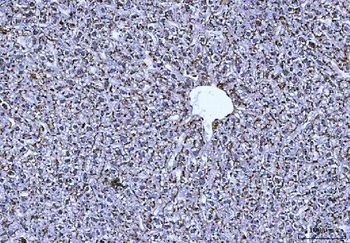 Cathepsin B/CTSB Antibody