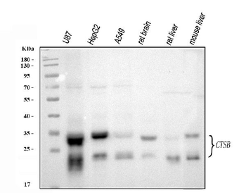 Cathepsin B/CTSB Antibody
