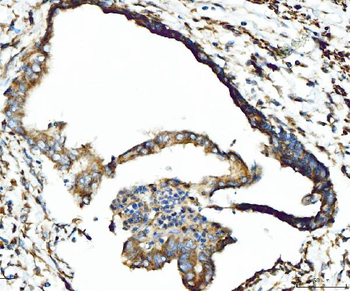 CPT1A Rabbit Polyclonal Antibody