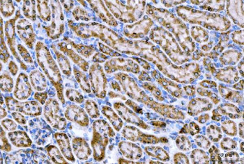 CPT1A Rabbit Polyclonal Antibody