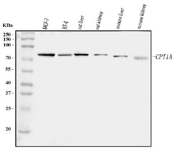 CPT1A Rabbit Polyclonal Antibody