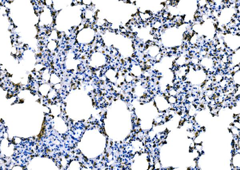 Dectin-1/Clec7a Rabbit Polyclonal Antibody